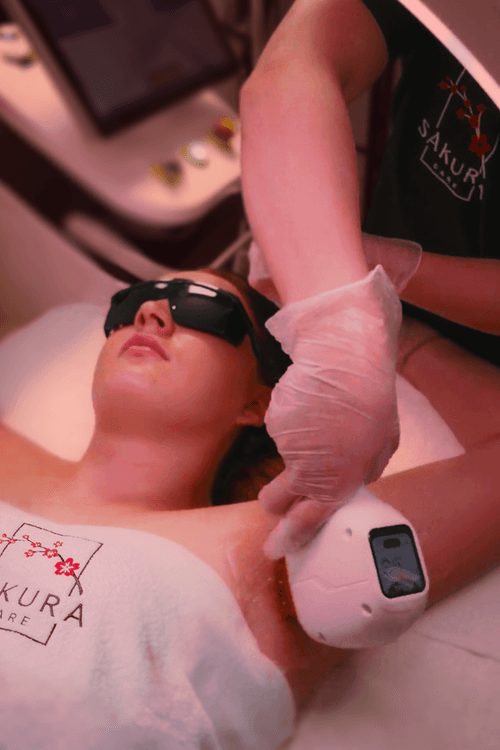 Une séance d’épilation laser à l’institut Sakura Care